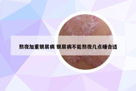 熬夜加重銀屑病 銀屑病不能熬夜幾點(diǎn)睡合適