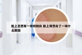 臉上忽然有一塊特別白 臉上突然白了一塊什么原因