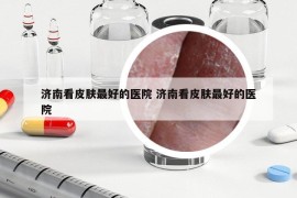 濟南看皮膚最好的醫(yī)院 濟南看皮膚最好的醫(yī)院