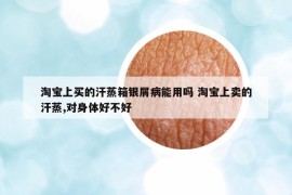 淘寶上買的汗蒸箱銀屑病能用嗎 淘寶上賣的汗蒸,對身體好不好
