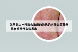 關于頭上一種洗頭治癬的洗頭的叫什么深藍色 頭有癬用什么洗發(fā)水