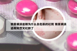 銀屑病消退期為什么會出新的紅斑 銀屑病消退期突然又紅腫了