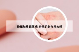 紛樂加重銀屑病 紛樂的副作用大嗎