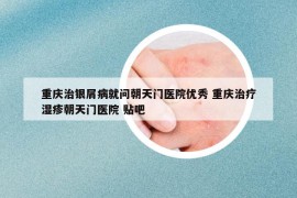 重慶治銀屑病就問朝天門醫(yī)院優(yōu)秀 重慶治療濕疹朝天門醫(yī)院 貼吧