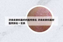 濟(jì)南皮膚科最好的醫(yī)院排名 濟(jì)南皮膚科最好醫(yī)院排名一覽表
