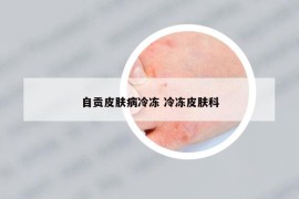 自貢皮膚病冷凍 冷凍皮膚科