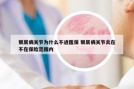 銀屑病關節(jié)為什么不進醫(yī)保 銀屑病關節(jié)炎在不在保險范圍內(nèi)
