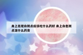 身上出現(xiàn)白斑點應該吃什么藥好 身上白色斑點涂什么藥膏
