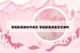 掌跖膿皰病有何癥狀 掌跖膿皰病是常見病嗎