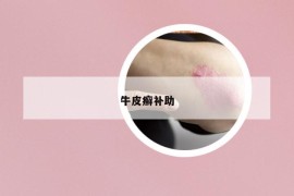 牛皮癬補(bǔ)助