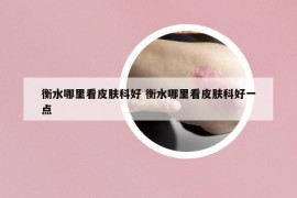 衡水哪里看皮膚科好 衡水哪里看皮膚科好一點(diǎn)
