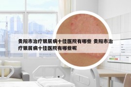 貴陽市治療銀屑病十佳醫(yī)院有哪些 貴陽市治療銀屑病十佳醫(yī)院有哪些呢