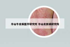 華山牛皮癬醫(yī)學(xué)研究院 華山皮膚病研究所