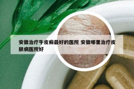 安徽治療牛皮癬最好的醫(yī)院 安徽哪里治療皮膚病醫(yī)院好