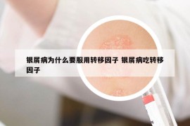 銀屑病為什么要服用轉移因子 銀屑病吃轉移因子