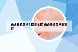 南通看銀屑病崋醫(yī)堂名醫(yī) 南通看銀屑病哪家好