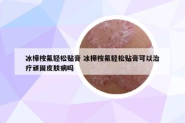 冰樟桉氟輕松貼膏 冰樟桉氟輕松貼膏可以治療頑固皮膚病嗎