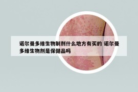 諾爾曼多維生物制劑什么地方有買的 諾爾曼多維生物劑是保健品嗎