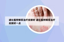 通化醫(yī)院哪家治療皮膚好 通化醫(yī)院哪家治療皮膚好一點(diǎn)