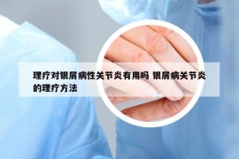 理療對(duì)銀屑病性關(guān)節(jié)炎有用嗎 銀屑病關(guān)節(jié)炎的理療方法