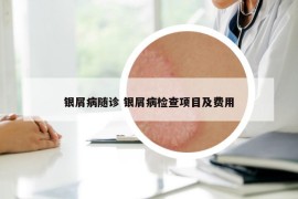 銀屑病隨診 銀屑病檢查項目及費(fèi)用