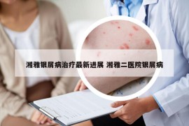 湘雅銀屑病治療最新進(jìn)展 湘雅二醫(yī)院銀屑病