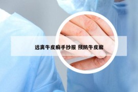遠離牛皮癬手抄報 預防牛皮廨