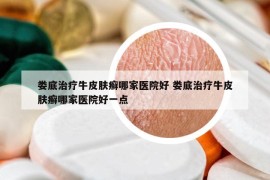 婁底治療牛皮膚癬哪家醫(yī)院好 婁底治療牛皮膚癬哪家醫(yī)院好一點(diǎn)