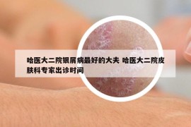 哈醫(yī)大二院銀屑病最好的大夫 哈醫(yī)大二院皮膚科專家出診時(shí)間