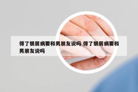 得了銀屑病要和男朋友說(shuō)嗎 得了銀屑病要和男朋友說(shuō)嗎