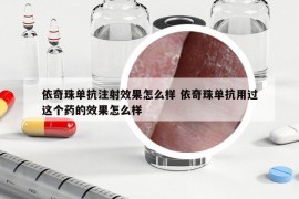 依奇珠單抗注射效果怎么樣 依奇珠單抗用過這個藥的效果怎么樣