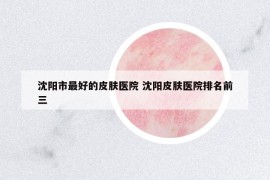 沈陽市最好的皮膚醫(yī)院 沈陽皮膚醫(yī)院排名前三