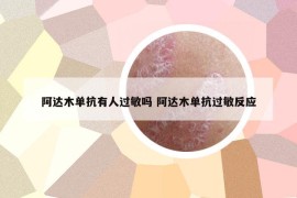 阿達(dá)木單抗有人過敏嗎 阿達(dá)木單抗過敏反應(yīng)