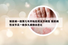 銀屑病一般第幾年開始出現(xiàn)關(guān)節(jié)病變 銀屑病性關(guān)節(jié)炎一般多久病情會(huì)惡化