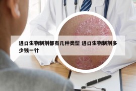 進(jìn)口生物制劑都有幾種類(lèi)型 進(jìn)口生物制劑多少錢(qián)一針