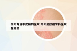 南陽(yáng)專治牛皮癬的醫(yī)院 南陽(yáng)皮膚病?？漆t(yī)院在哪里