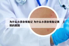 為什么小孩會(huì)有胎記 為什么小孩會(huì)有胎記黑斑的原因