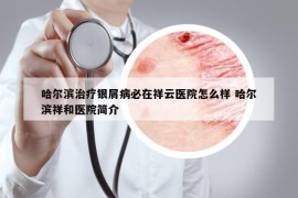 哈爾濱治療銀屑病必在祥云醫(yī)院怎么樣 哈爾濱祥和醫(yī)院簡(jiǎn)介