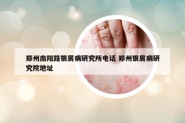 鄭州南陽(yáng)路銀屑病研究所電話 鄭州銀屑病研究院地址