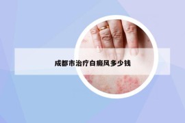成都市治療白癜風(fēng)多少錢