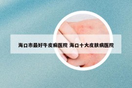 ?？谑凶詈门Ｆぐ_醫(yī)院 海口十大皮膚病醫(yī)院