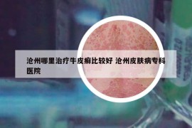 滄州哪里治療牛皮癬比較好 滄州皮膚病專科醫(yī)院