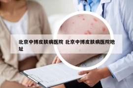 北京中博皮膚病醫(yī)院 北京中博皮膚病醫(yī)院地址