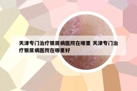 天津?qū)ｉT治療銀屑病醫(yī)院在哪里 天津?qū)ｉT治療銀屑病醫(yī)院在哪里好