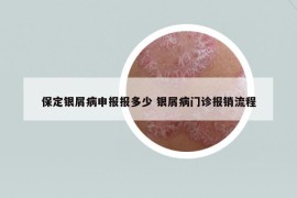 保定銀屑病申報(bào)報(bào)多少 銀屑病門診報(bào)銷流程