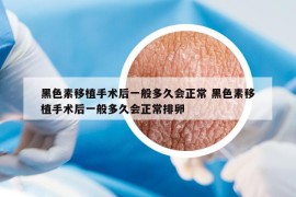 黑色素移植手術(shù)后一般多久會(huì)正常 黑色素移植手術(shù)后一般多久會(huì)正常排卵