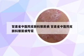 甘肅省中醫(yī)院皮膚科銀屑病 甘肅省中醫(yī)院皮膚科銀屑病專家