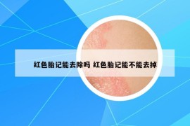 紅色胎記能去除嗎 紅色胎記能不能去掉