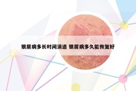 銀屑病多長時間消退 銀屑病多久能恢復(fù)好