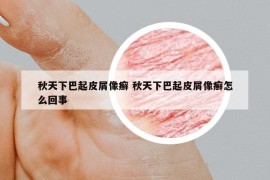 秋天下巴起皮屑像癬 秋天下巴起皮屑像癬怎么回事